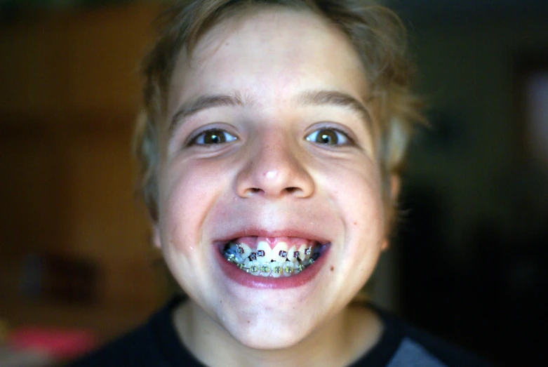 a  with ces on his teeth looking to the left