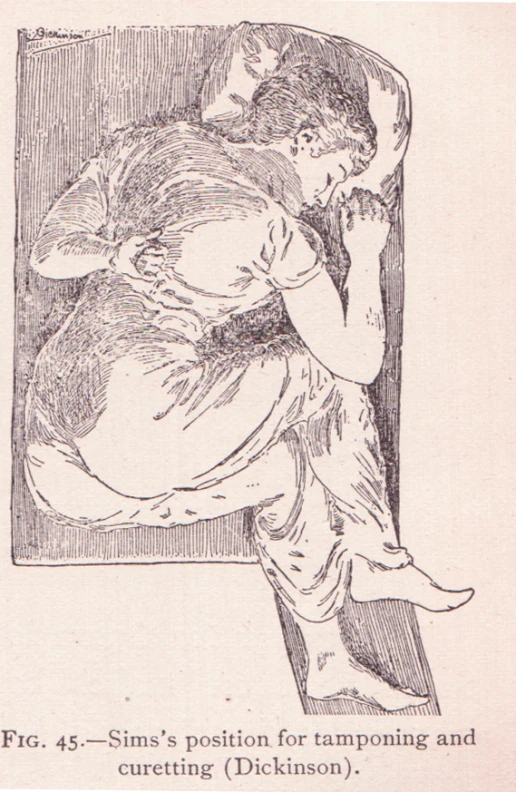 this is an old drawing of a woman sitting down with her hand on her chin