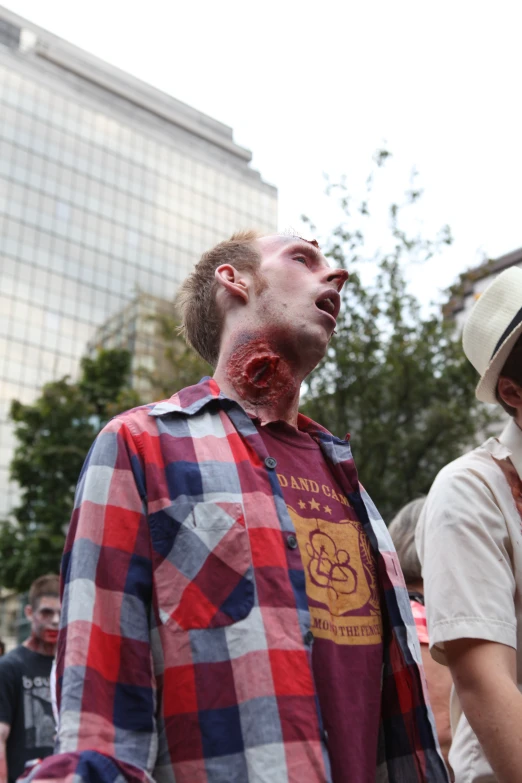 a man in a checkered shirt with his nose bleeding