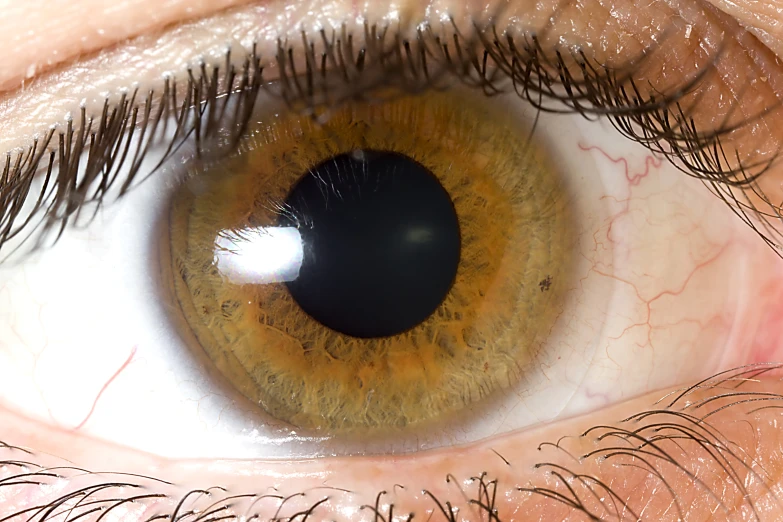 the upper part of an eye that has wrinkles and no lens