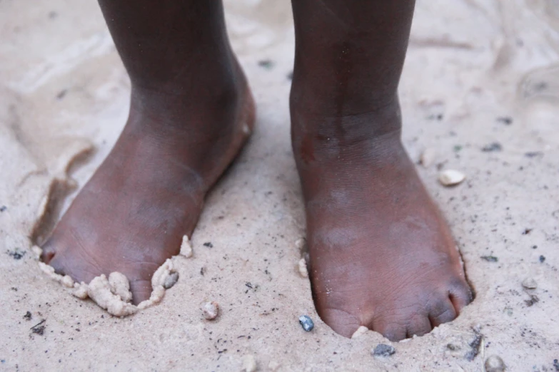 a person with sand on their feet and dirt in their toes