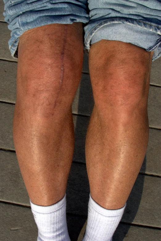 an image of a pair of legs that are ripped