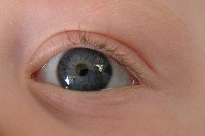 close up s of an eye with one small blue iris