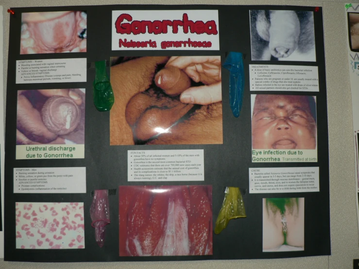 the poster has pictures of baby feces in it