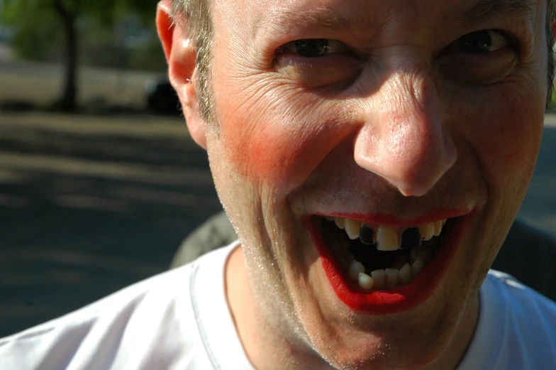 a closeup of the teeth on this creepy man
