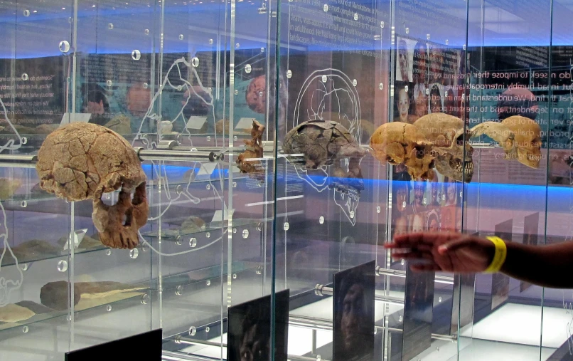 there are many human skulls on display in this case