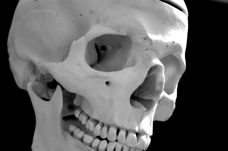 a skull is shown with one jaw missing