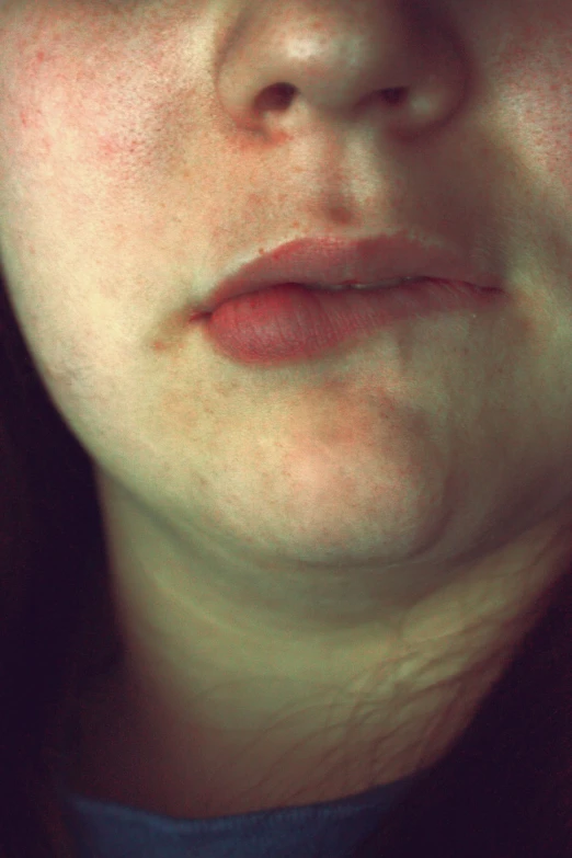 a person with brown eyes has red, bruised lips