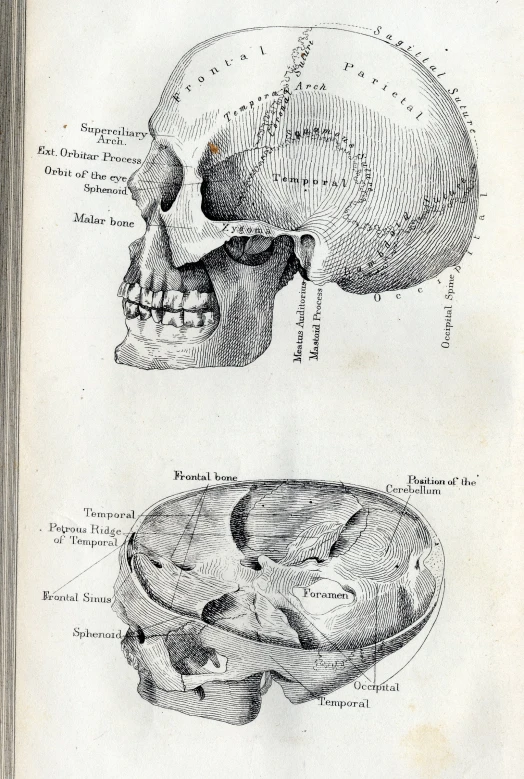 the diagram shows an image of a human skull with two sections labeled