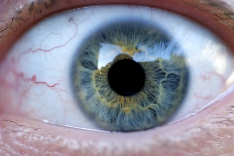 an eye with an iris that appears to have a blue and gold center