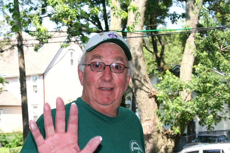 an older man with glasses shows a hand for the camera