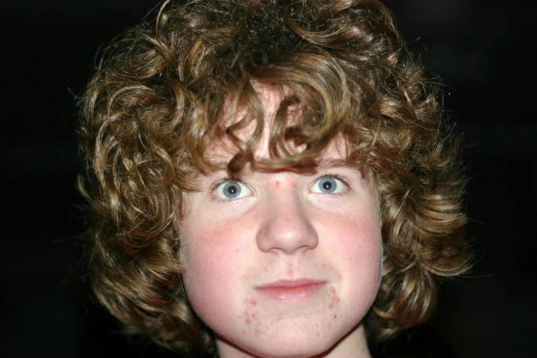 a boy with curly hair has blue eyes and brown spots on his face