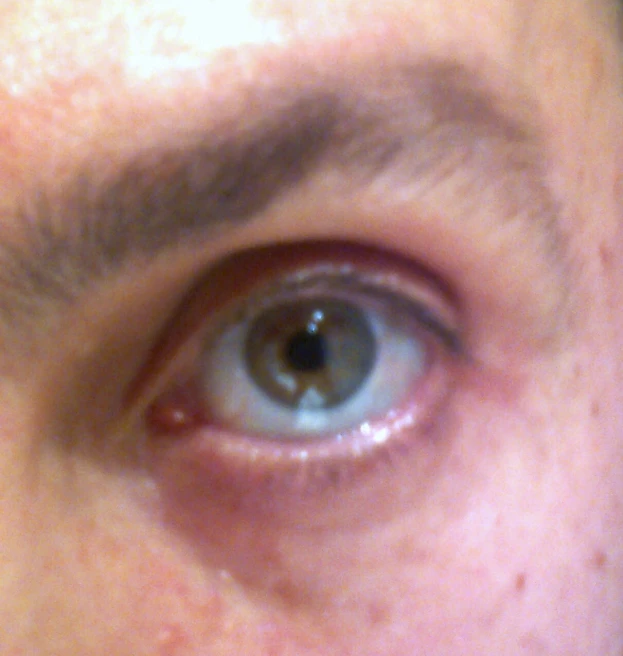 close up image of the brown spots on the eye of a person