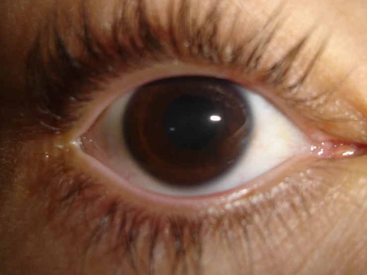 an eye showing the inside of it