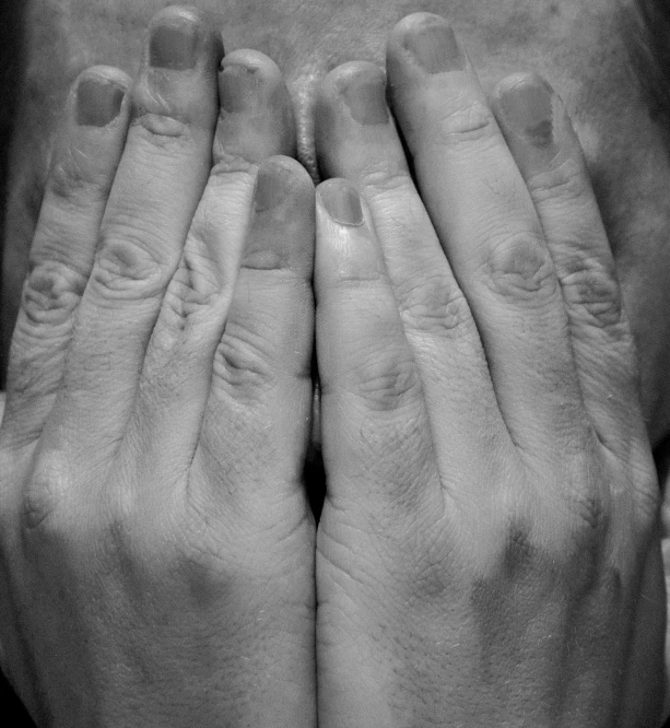 black and white image of hands covering the face