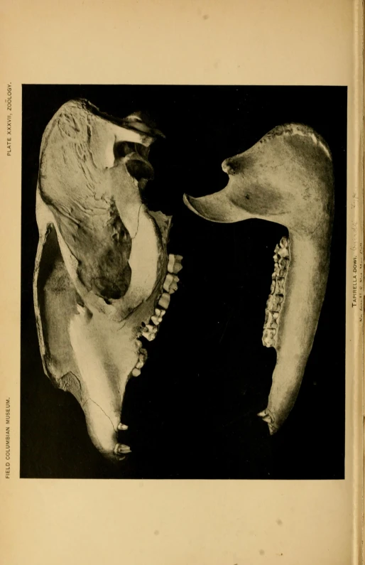 the image shows the human skull and teeth