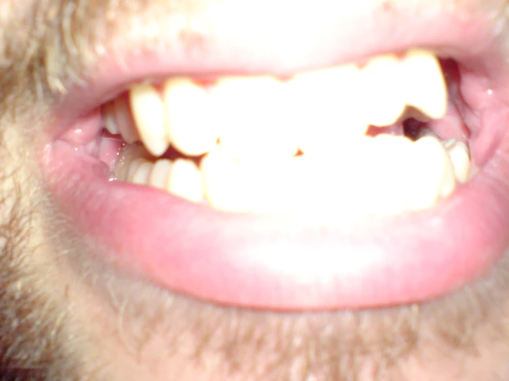 a close up po of a man's mouth with one missing