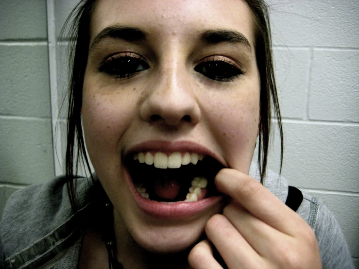 a young lady is smiling with her teeth whitening