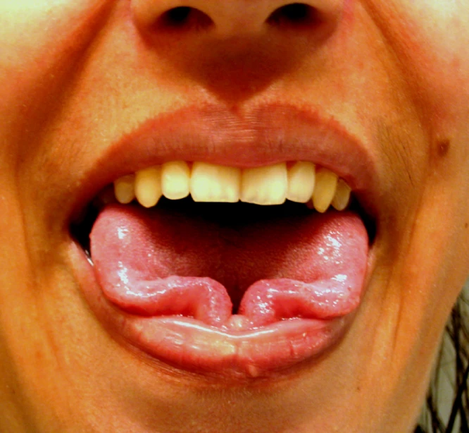 a woman's mouth showing the bottom part of her tongue