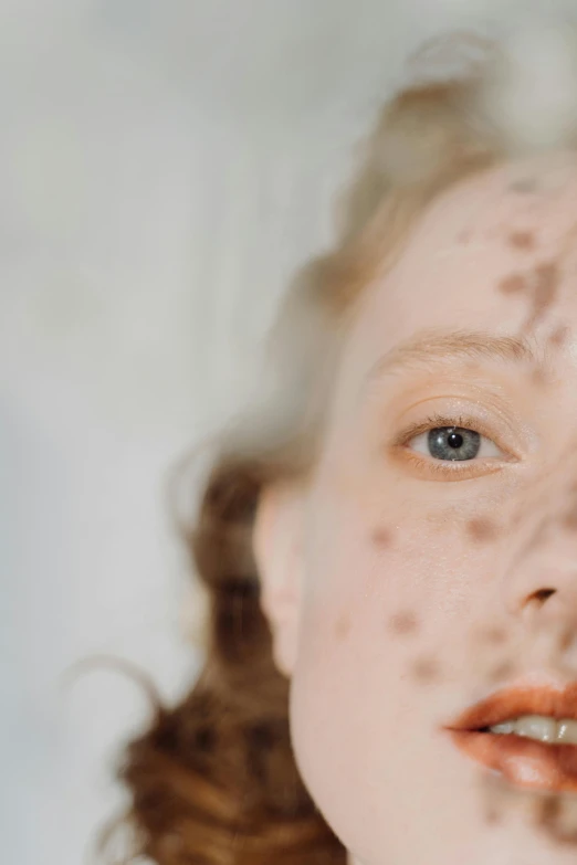 a close up of a woman with freckles on her face, an album cover, inspired by Elsa Bleda, trending on pexels, beautifully infected, on a pale background, beauty is a virus, low - angle shot