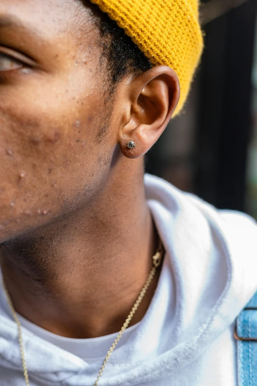 a close up of a person wearing a yellow hat, trending on pexels, hyperrealism, small studded earings, handsome hip hop young black man, facial scar, skincare