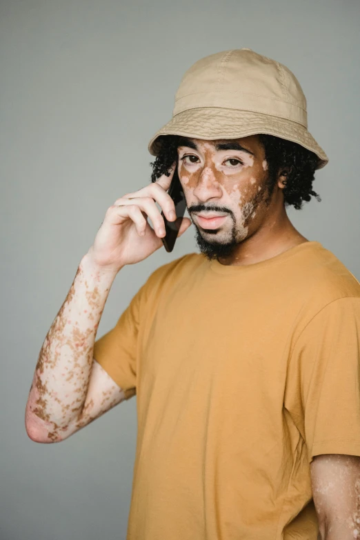 a man with dirt all over his face talking on a cell phone, trending on pexels, renaissance, tan complexion, hairy arms, brown hat, pustules