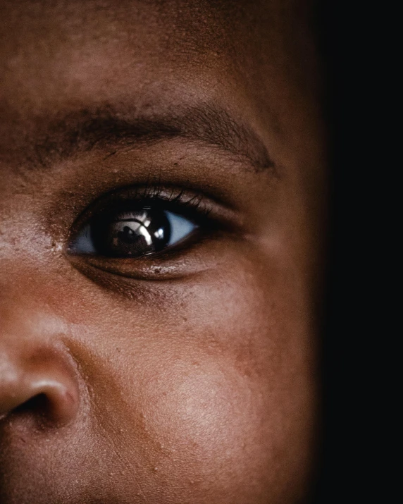 a close up of a child's face with a black background, trending on unsplash, with brown skin, white around right eye, young child, african