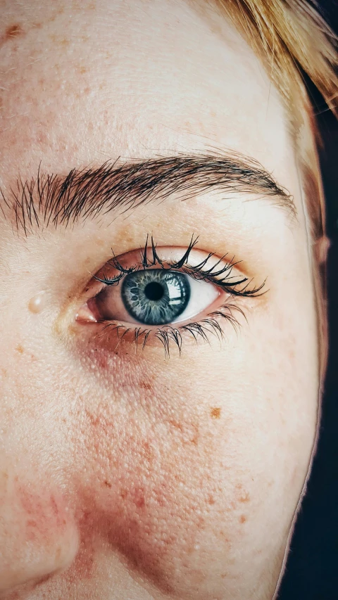 a close up of a person's eye with freckles, a stipple, trending on pexels, scar on the cheek, instagram post, blue pupil, female looking