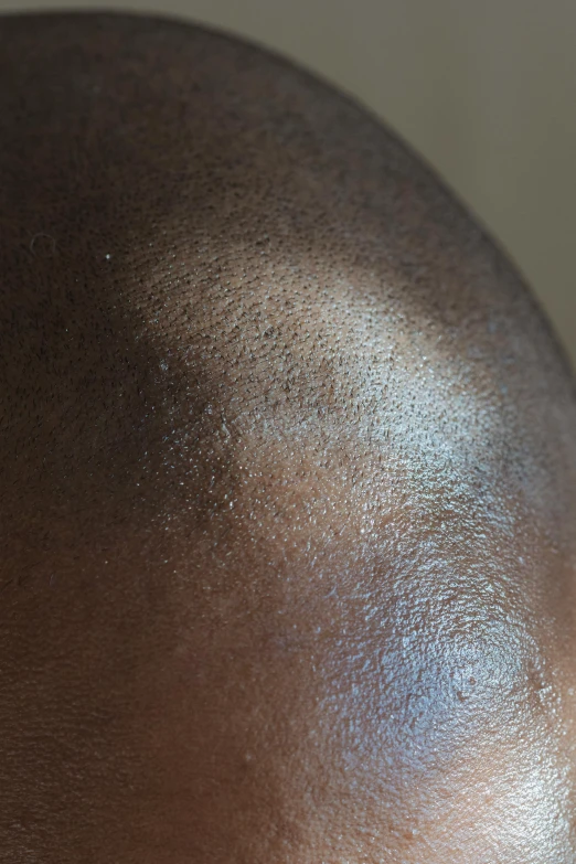 a close up of the back of a man's head, hurufiyya, dark skin tone, bald patch, close-up photograph, upper body image