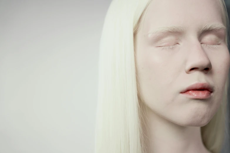 a close up of a person with white hair, inspired by Vanessa Beecroft, albino dwarf, unconscious, eero aarnio, with white long hair