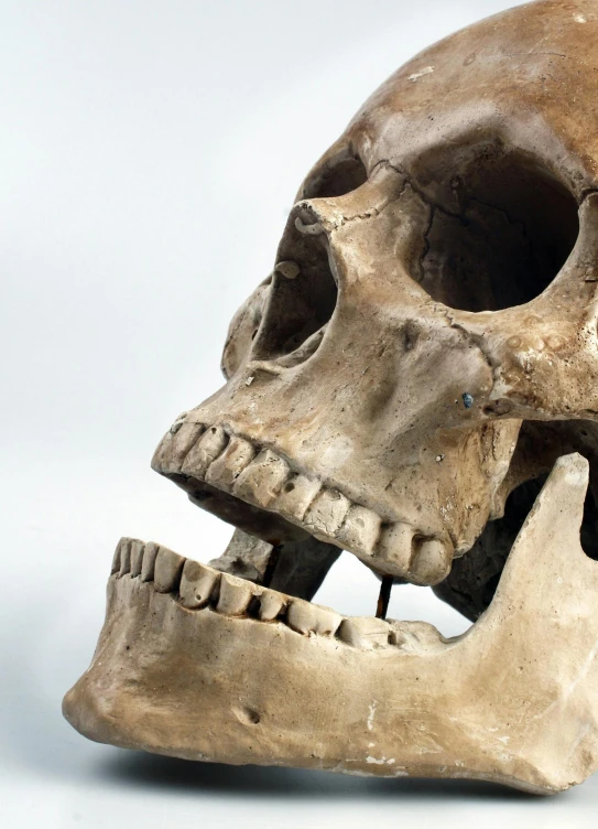 a close up of a human skull with a missing jaw, reddit, square jaw, slide show, historical, illustration »