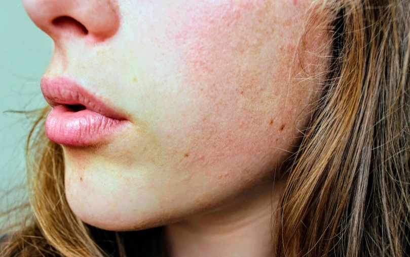 a close up of a woman with freckles on her face, trending on pexels, burn scar left cheek, illustration », extremely pale, bottom body close up