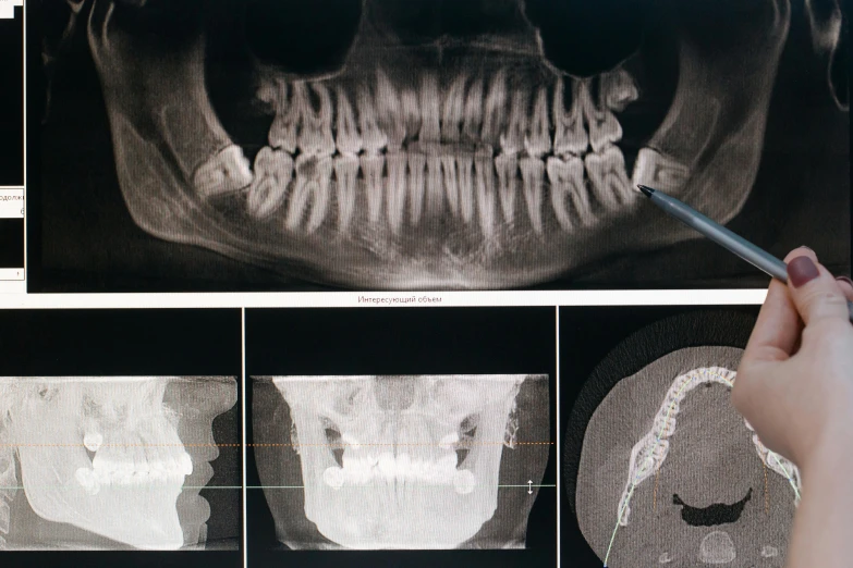 a close up of a person holding a toothbrush, a digital rendering, unsplash, hyperrealism, inset xray cross-section, large metal jaw, panoramic shot, 1940s photo