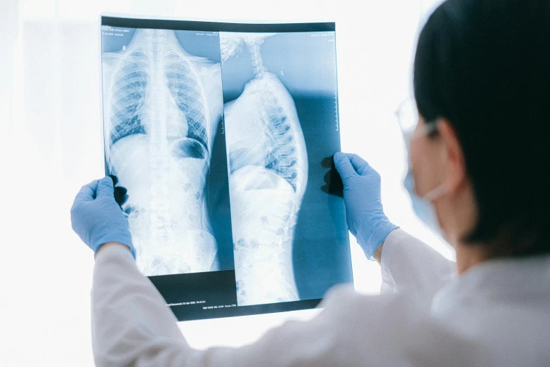 a woman is looking at an x - ray image, pexels contest winner, hurufiyya, back towards camera, surgical gear, huge spines, lungs