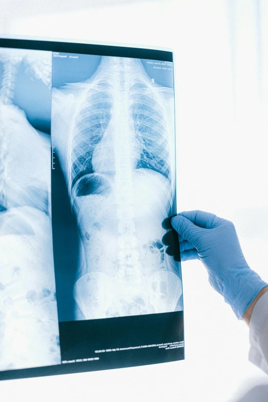 a person in a lab coat is looking at an x - ray, renaissance, white human spine, bay area, no cropping, medium - shot