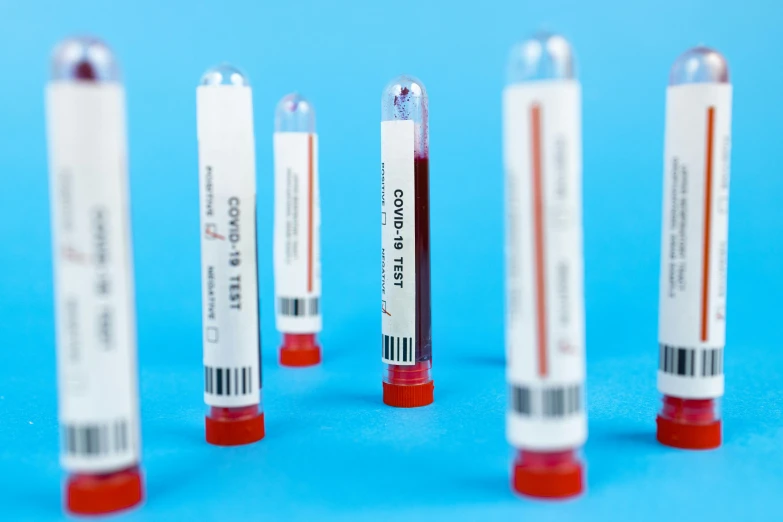 a row of blood tubes sitting on top of a blue surface, private press, coronavirus, medical labels, gauges, thumbnail
