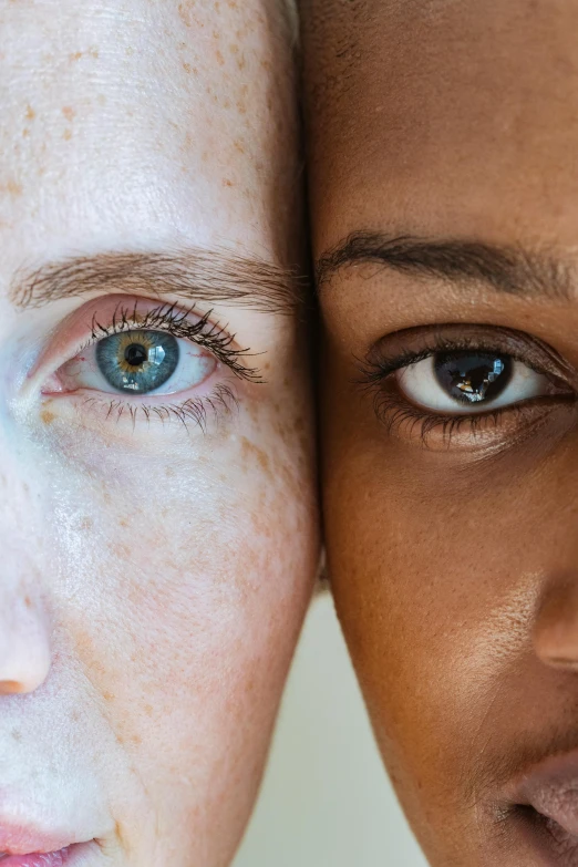 a close up of two people with freckles on their faces, by Carey Morris, trending on unsplash, various eye shapes, mixed-race woman, diverse, (colour) eyes