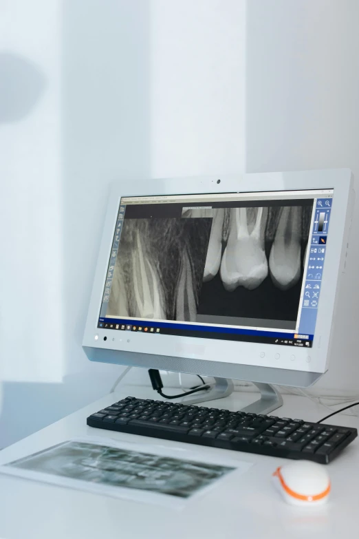 a computer monitor sitting on top of a desk, exposed bone, uniform teeth, technological screens, profile image
