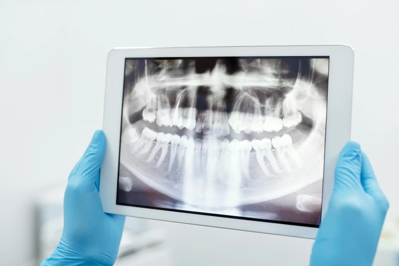 a person in blue gloves holding up a tablet computer, a hologram, showing teeth, x ray, instagram post, close angle