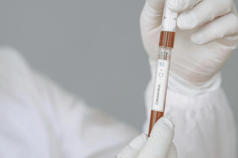 a person in white gloves holding a blood test tube, inspired by Évariste Vital Luminais, unsplash, gradient brown to white, iv pole, professional closeup photo, avatar image