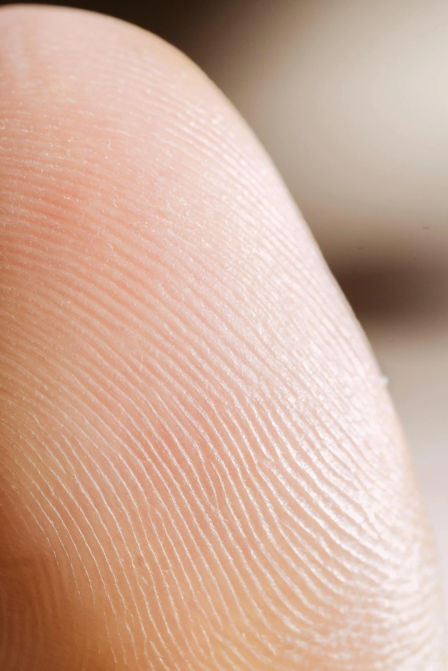 a close up of a finger with a ring on it, a macro photograph, by David Simpson, skin pore detail, curved, bald lines, pale - white skin