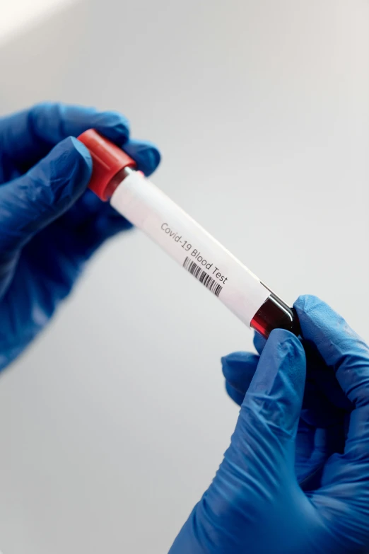 a person in blue gloves holding a blood test tube, label, slightly red, thumbnail, a wide shot