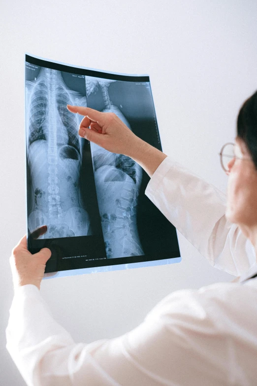 a woman in a white shirt is looking at a x - ray, unsplash, huge spines, taken in the late 2000s, fracture, overlooking