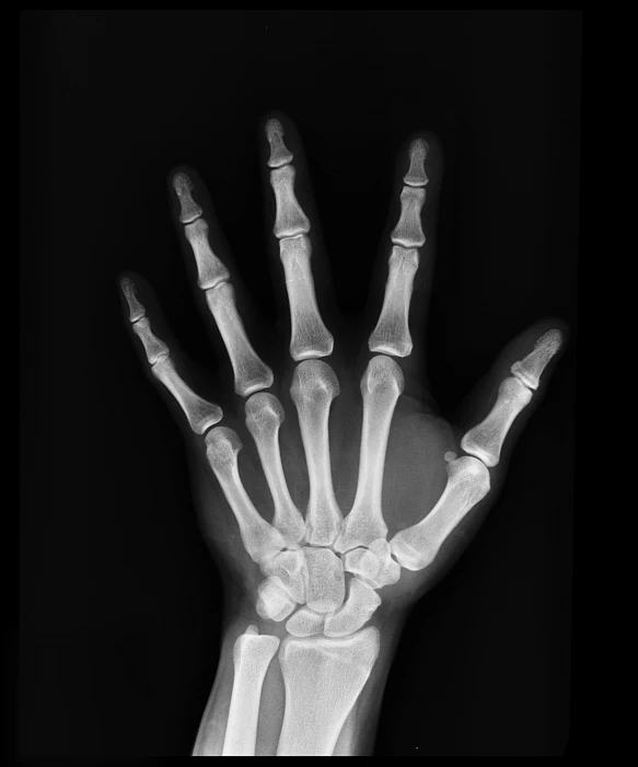a black and white photo of a hand, inset xray cross-section, ergodox, bone to bone, hires