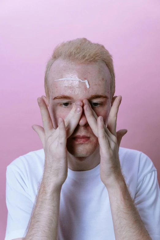 a man covering his eyes with his hands, an album cover, albino white pale skin, thin scar on his forehead, smooth pink skin, rhys lee