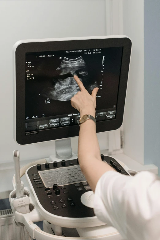 a woman in a white shirt is looking at a computer screen, membrane pregnancy sac, taken in 2022, bump in form of hand, veins popping out