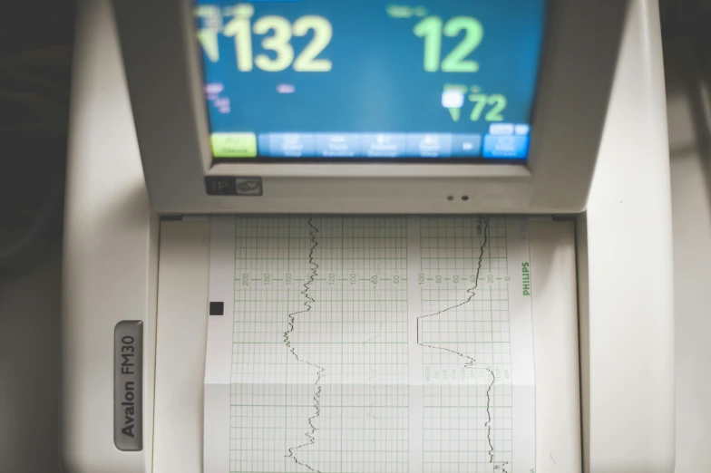 a close up of a monitor on a table, by Meredith Dillman, unsplash, analytical art, heart operation, pregnancy, waveforms on top of square chart, 15081959 21121991 01012000 4k