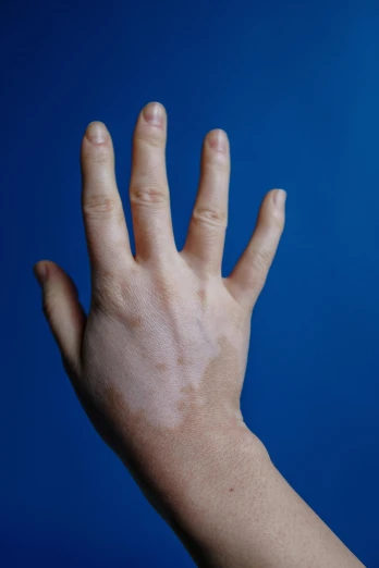 a close up of a person's hand on a blue background, marfan syndrome, square, alex kanevsky, large)}]