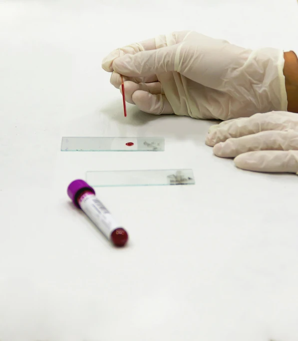 a person in white gloves holding a blood test tube, on a white table, digital image, image