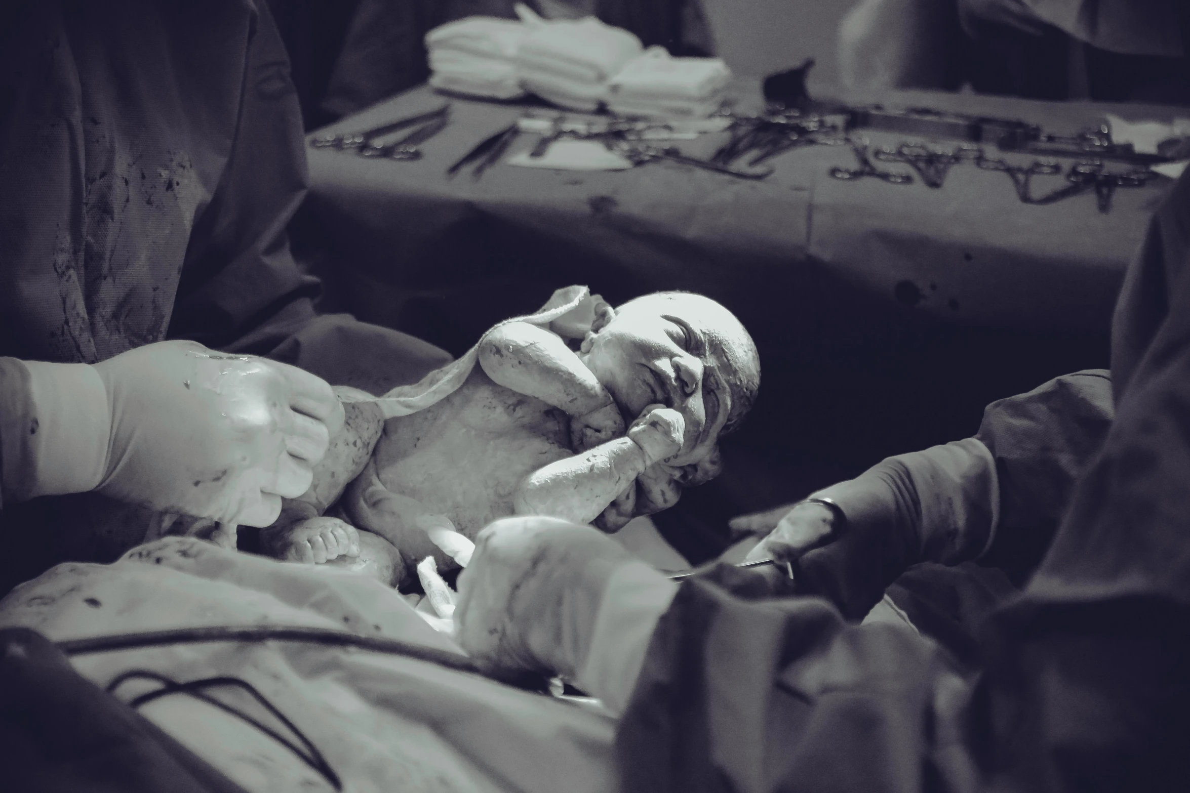 a black and white photo of a person holding a baby, by Dan Frazier, pexels contest winner, massurrealism, surgical impliments, sculpting, on an operating table, cutecore